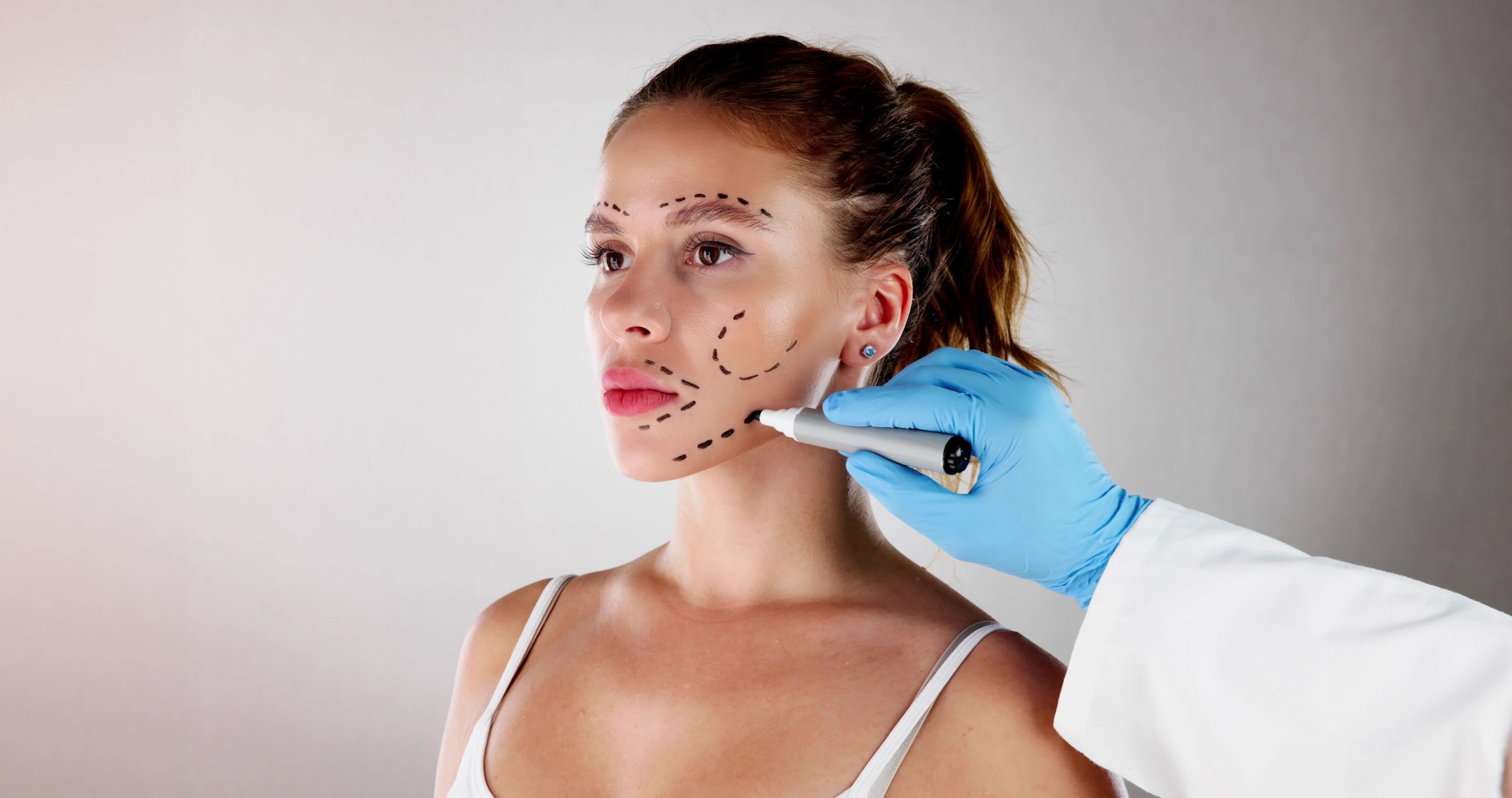 Facelift