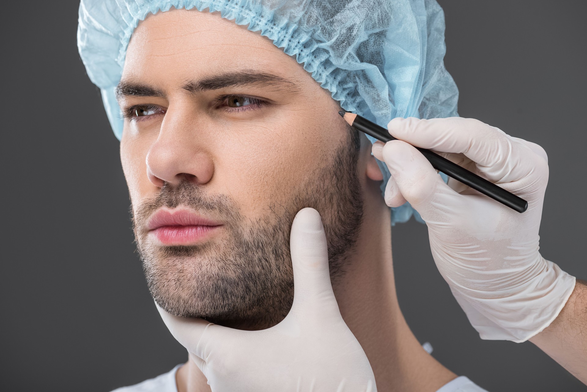 Barttransplantation