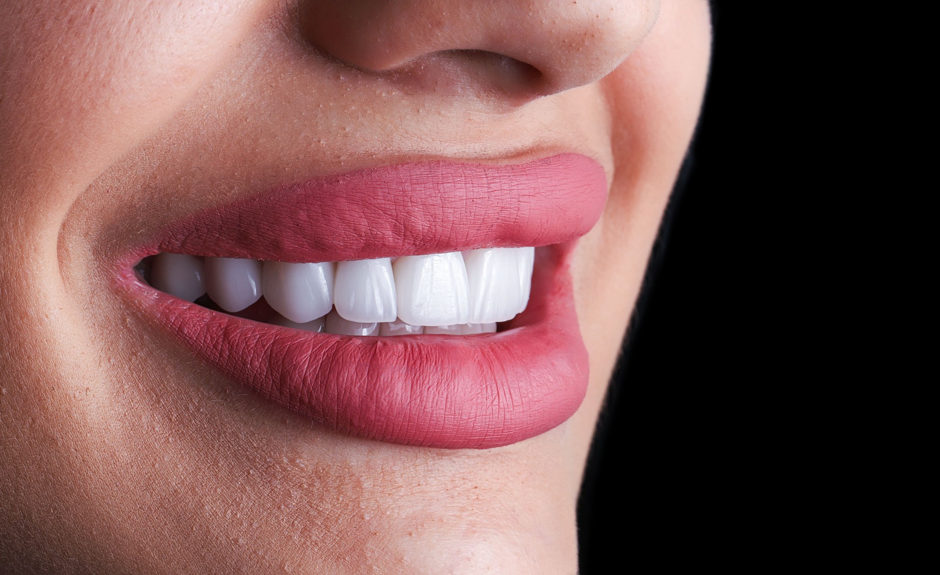 Paket 3 - Hollywood smile