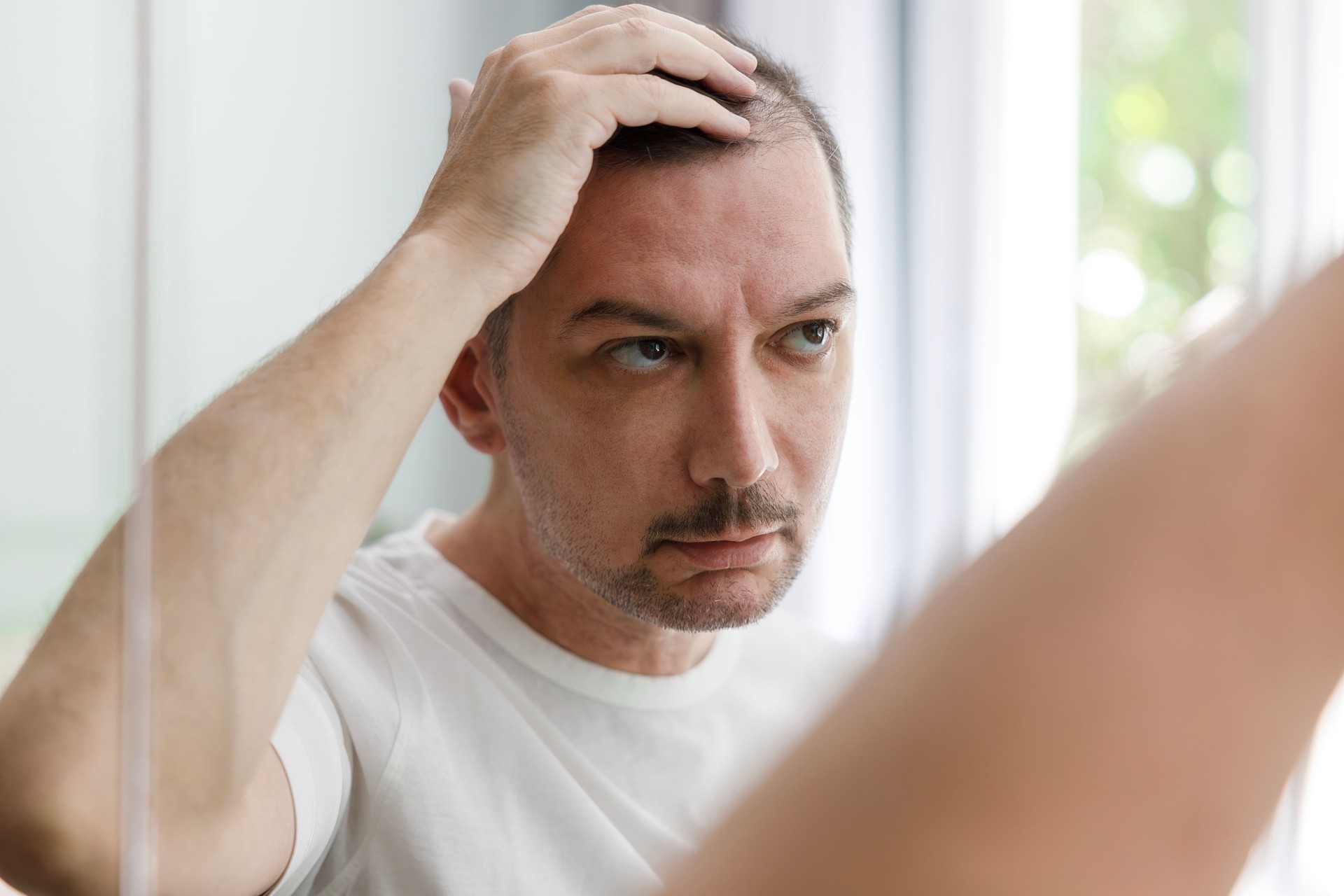 Haartransplantation