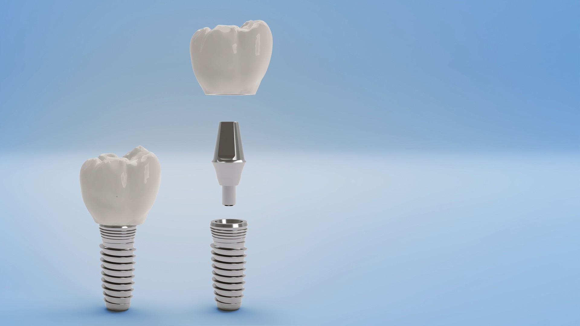 Zirkonkrone auf einem Implant