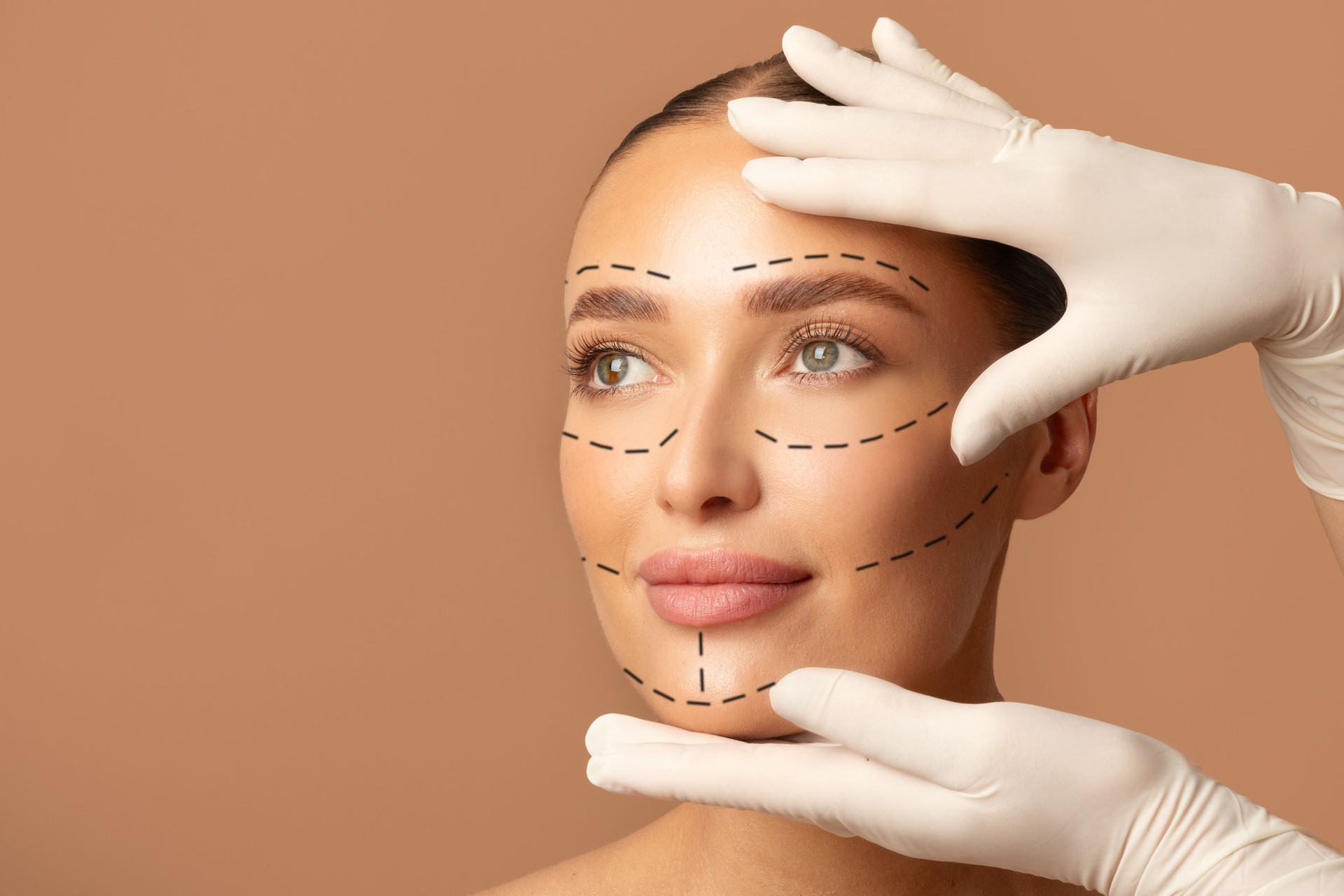 Facelifting